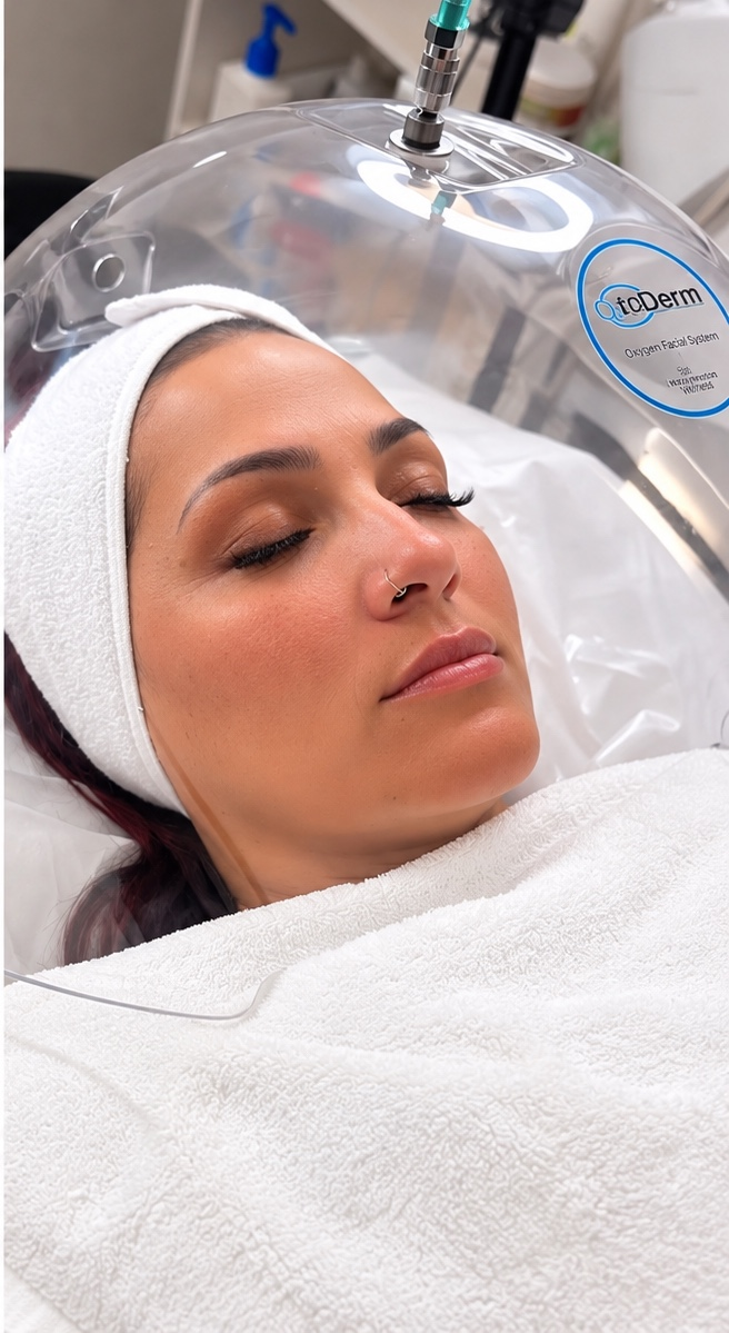 Sesión de oxigenoterapia facial en Emporio